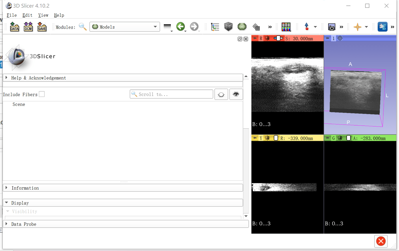 3D 3DSlicer 3d-3dslicer
