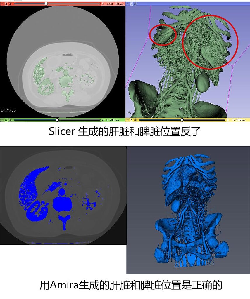 导入CT切片组生成模型脏器位置方向反了 - 3DSlicer | 课程答疑 - 3DSlicer龙虾社区
