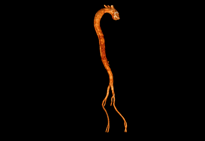 GIF