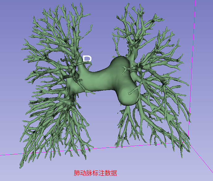 lung06.jpeg